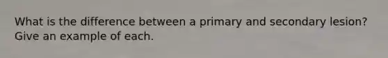 What is the difference between a primary and secondary lesion? Give an example of each.