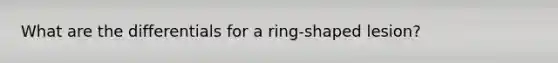 What are the differentials for a ring-shaped lesion?