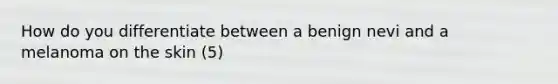 How do you differentiate between a benign nevi and a melanoma on the skin (5)