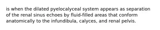 is when the dilated pyelocalyceal system appears as separation of the renal sinus echoes by fluid-filled areas that conform anatomically to the infundibula, calyces, and renal pelvis.