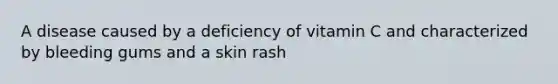 A disease caused by a deficiency of vitamin C and characterized by bleeding gums and a skin rash