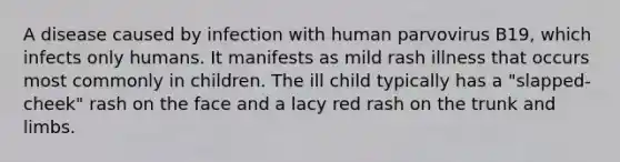 A disease caused by infection with human parvovirus B19, which infects only humans. It manifests as mild rash illness that occurs most commonly in children. The ill child typically has a "slapped-cheek" rash on the face and a lacy red rash on the trunk and limbs.