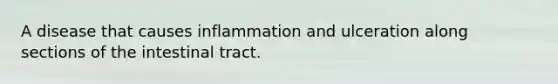 A disease that causes inflammation and ulceration along sections of the intestinal tract.