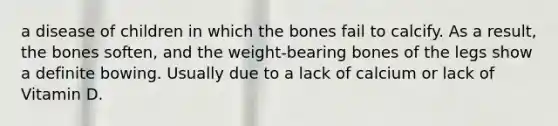 a disease of children in which the bones fail to calcify. As a result, the bones soften, and the weight-bearing bones of the legs show a definite bowing. Usually due to a lack of calcium or lack of Vitamin D.