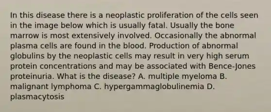 In this disease there is a neoplastic proliferation of the cells seen in the image below which is usually fatal. Usually the bone marrow is most extensively involved. Occasionally the abnormal plasma cells are found in the blood. Production of abnormal globulins by the neoplastic cells may result in very high serum protein concentrations and may be associated with Bence-Jones proteinuria. What is the disease? A. multiple myeloma B. malignant lymphoma C. hypergammaglobulinemia D. plasmacytosis