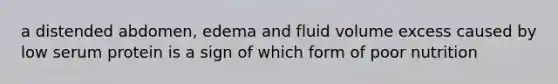a distended abdomen, edema and fluid volume excess caused by low serum protein is a sign of which form of poor nutrition