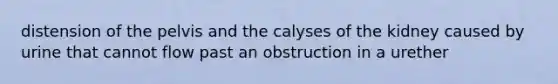 distension of the pelvis and the calyses of the kidney caused by urine that cannot flow past an obstruction in a urether