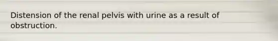 Distension of the renal pelvis with urine as a result of obstruction.