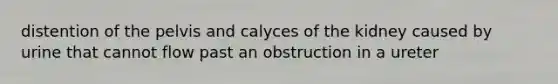 distention of the pelvis and calyces of the kidney caused by urine that cannot flow past an obstruction in a ureter