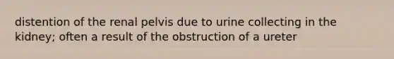 distention of the renal pelvis due to urine collecting in the kidney; often a result of the obstruction of a ureter