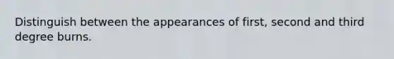 Distinguish between the appearances of first, second and third degree burns.