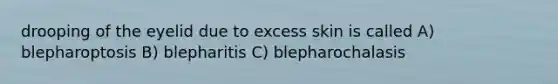 drooping of the eyelid due to excess skin is called A) blepharoptosis B) blepharitis C) blepharochalasis