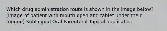 Which drug administration route is shown in the image below? (image of patient with mouth open and tablet under their tongue) Sublingual Oral Parenteral Topical application