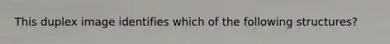 This duplex image identifies which of the following structures?