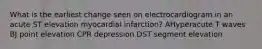 What is the earliest change seen on electrocardiogram in an acute ST elevation myocardial infarction? AHyperacute T waves BJ point elevation CPR depression DST segment elevation