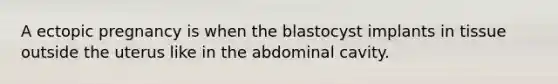 A ectopic pregnancy is when the blastocyst implants in tissue outside the uterus like in the abdominal cavity.