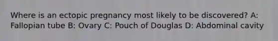 Where is an ectopic pregnancy most likely to be discovered? A: Fallopian tube B: Ovary C: Pouch of Douglas D: Abdominal cavity