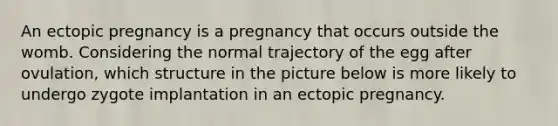 An ectopic pregnancy is a pregnancy that occurs outside the womb. Considering the normal trajectory of the egg after ovulation, which structure in the picture below is more likely to undergo zygote implantation in an ectopic pregnancy.