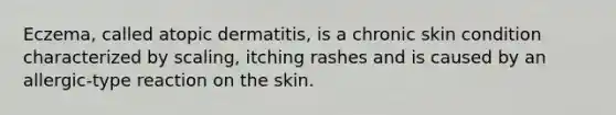 Eczema, called atopic dermatitis, is a chronic skin condition characterized by scaling, itching rashes and is caused by an allergic-type reaction on the skin.