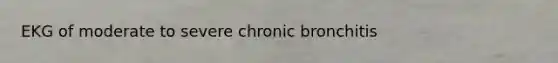 EKG of moderate to severe chronic bronchitis