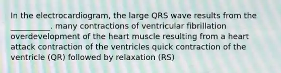 In the electrocardiogram, the large QRS wave results from the __________. many contractions of ventricular fibrillation overdevelopment of <a href='https://www.questionai.com/knowledge/kya8ocqc6o-the-heart' class='anchor-knowledge'>the heart</a> muscle resulting from a heart attack contraction of the ventricles quick contraction of the ventricle (QR) followed by relaxation (RS)