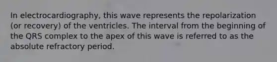 In electrocardiography, this wave represents the repolarization (or recovery) of the ventricles. The interval from the beginning of the QRS complex to the apex of this wave is referred to as the absolute refractory period.