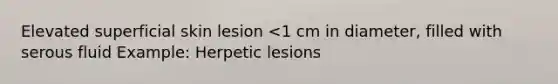 Elevated superficial skin lesion <1 cm in diameter, filled with serous fluid Example: Herpetic lesions