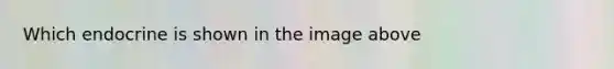 Which endocrine is shown in the image above
