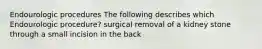 Endourologic procedures The following describes which Endourologic procedure? surgical removal of a kidney stone through a small incision in the back