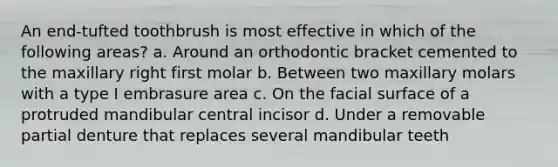 An end-tufted toothbrush is most effective in which of the following areas? a. Around an orthodontic bracket cemented to the maxillary right first molar b. Between two maxillary molars with a type I embrasure area c. On the facial surface of a protruded mandibular central incisor d. Under a removable partial denture that replaces several mandibular teeth