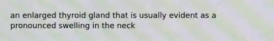 an enlarged thyroid gland that is usually evident as a pronounced swelling in the neck