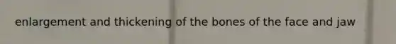 enlargement and thickening of the bones of the face and jaw