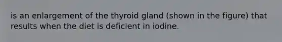 is an enlargement of the thyroid gland (shown in the figure) that results when the diet is deficient in iodine.