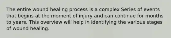 The entire wound healing process is a complex Series of events that begins at the moment of injury and can continue for months to years. This overview will help in identifying the various stages of wound healing.