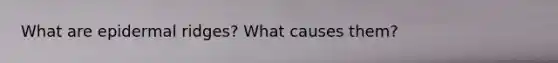 What are epidermal ridges? What causes them?