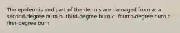 The epidermis and part of the dermis are damaged from a: a. second-degree burn b. third-degree burn c. fourth-degree burn d. first-degree burn