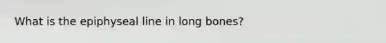 What is the epiphyseal line in long bones?