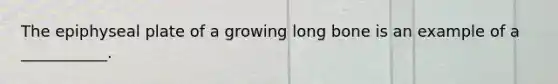 The epiphyseal plate of a growing long bone is an example of a ___________.