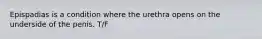 Epispadias is a condition where the urethra opens on the underside of the penis. T/F