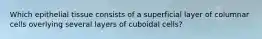 Which epithelial tissue consists of a superficial layer of columnar cells overlying several layers of cuboidal cells?