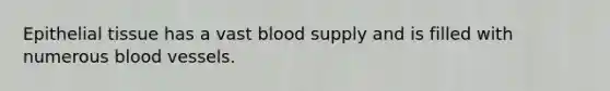 Epithelial tissue has a vast blood supply and is filled with numerous blood vessels.