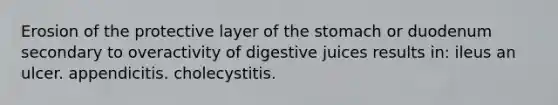 Erosion of the protective layer of the stomach or duodenum secondary to overactivity of digestive juices results in: ileus an ulcer. appendicitis. cholecystitis.