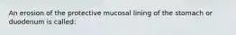 An erosion of the protective mucosal lining of the stomach or duodenum is called: