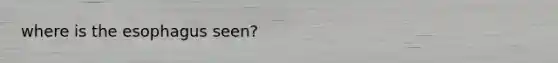 where is the esophagus seen?