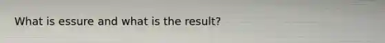 What is essure and what is the result?