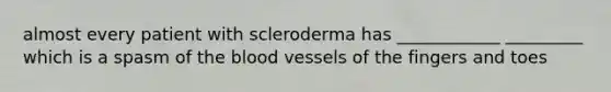 almost every patient with scleroderma has ____________ _________ which is a spasm of the blood vessels of the fingers and toes