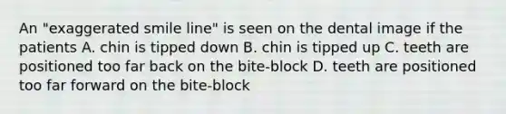 An "exaggerated smile line" is seen on the dental image if the patients A. chin is tipped down B. chin is tipped up C. teeth are positioned too far back on the bite-block D. teeth are positioned too far forward on the bite-block