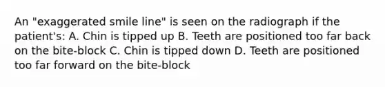 An "exaggerated smile line" is seen on the radiograph if the patient's: A. Chin is tipped up B. Teeth are positioned too far back on the bite-block C. Chin is tipped down D. Teeth are positioned too far forward on the bite-block