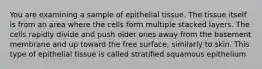 You are examining a sample of epithelial tissue. The tissue itself is from an area where the cells form multiple stacked layers. The cells rapidly divide and push older ones away from the basement membrane and up toward the free surface, similarly to skin. This type of epithelial tissue is called stratified squamous epithelium