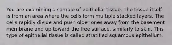 You are examining a sample of epithelial tissue. The tissue itself is from an area where the cells form multiple stacked layers. The cells rapidly divide and push older ones away from the basement membrane and up toward the free surface, similarly to skin. This type of epithelial tissue is called stratified squamous epithelium.